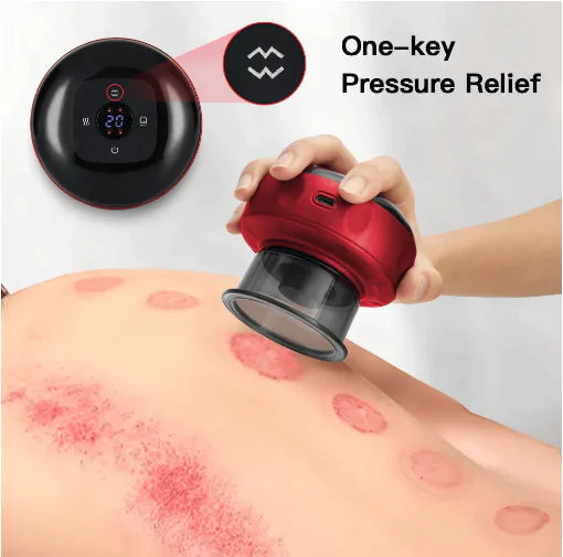 CuppMaster - Electric Vacuum Cupping Massager