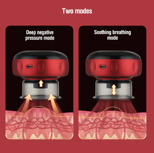 CuppMaster - Electric Vacuum Cupping Massager